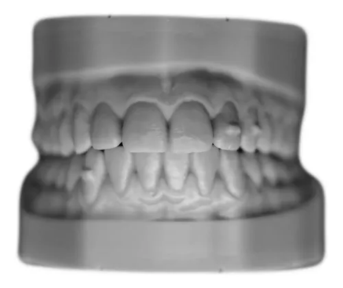 Resina 3d Cosmos Plus Gris Dental Model 1kg Alta Velocidad